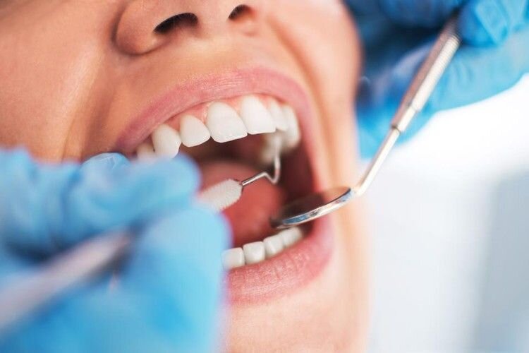 Soins dentaires