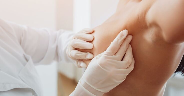 Chirurgie des seins